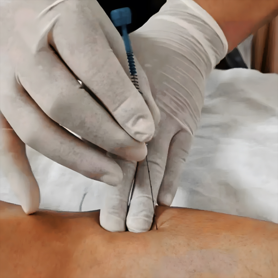 Услуга бронирования в традиционной китайской медицине (зачитывается в стоимость лечения) — изображение 4